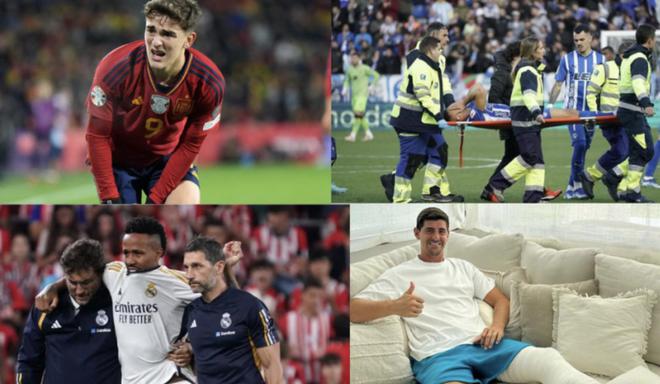 导致失球 导致失球